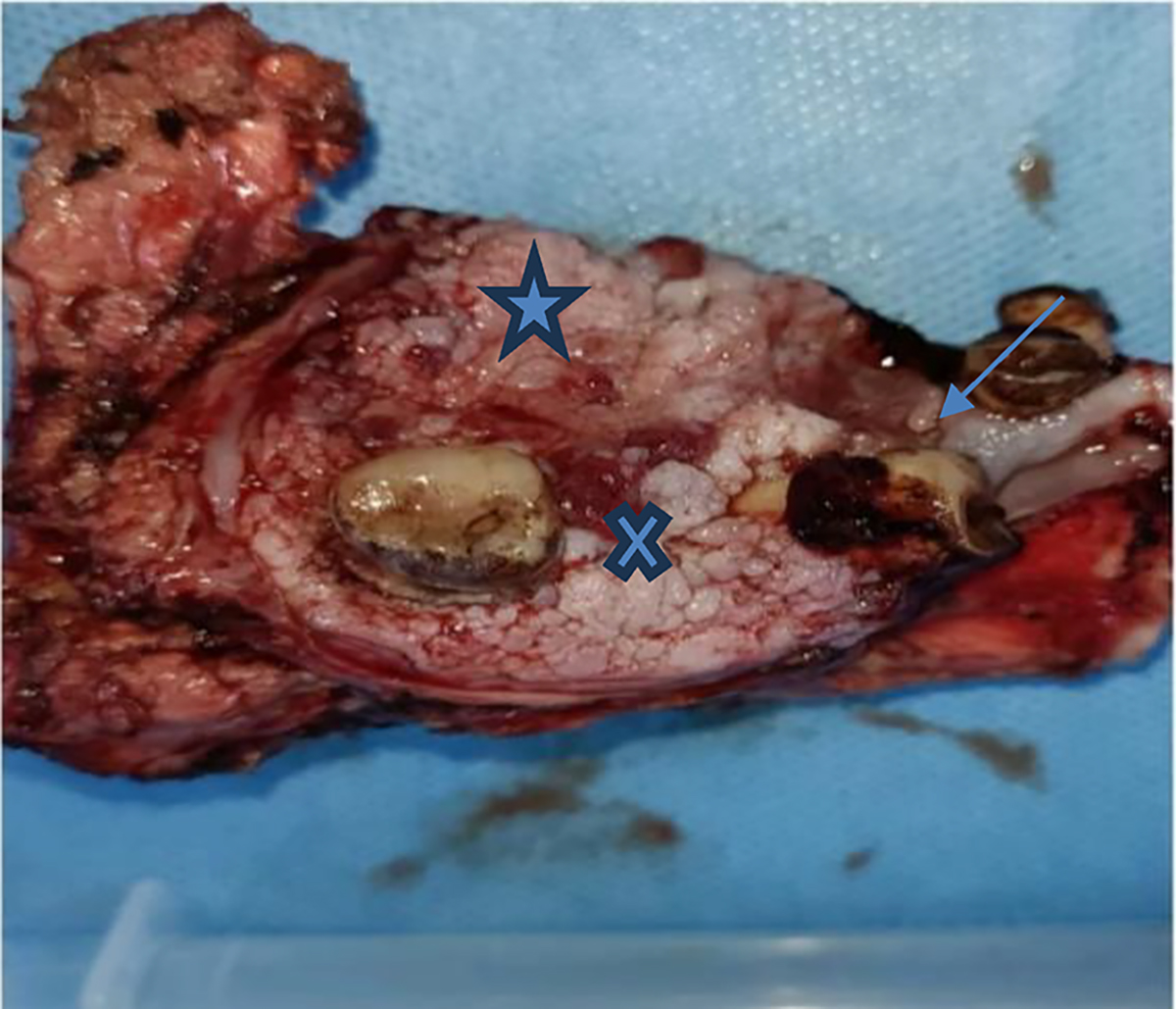 Figure 1 Refer to the following caption and surrounding text.